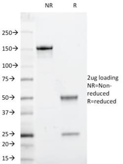beta 2-Microglobulin Antibody (246-E9.E7 (same as HLA.ABC.m2)), Novus Biologicals:Antibodies:Primary